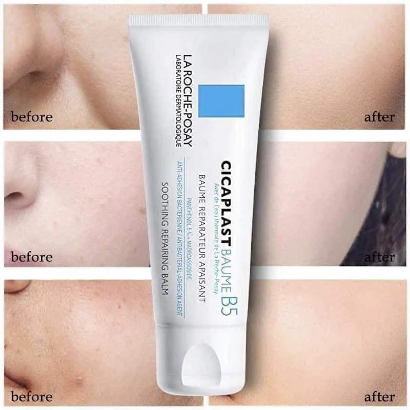 CICAPLAST BAUME B5+ KEM DƯỠNG PHỤC HỒI ĐA CÔNG DỤNG, PHỤC HỒI HIỆU QUẢ SAU 1H CICAPLAST BAUME B5+40ML