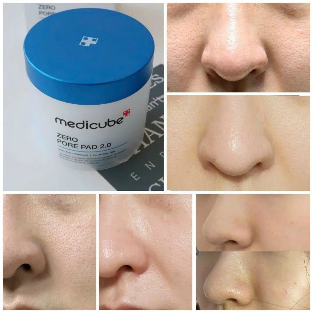 Toner Medicube Zero Pore Pad 2.0 70 miếng