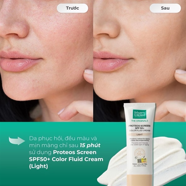 Kem chống nắng nâng tông MartiDerm Proteos Screen SPF50+ Color Fluid Cream