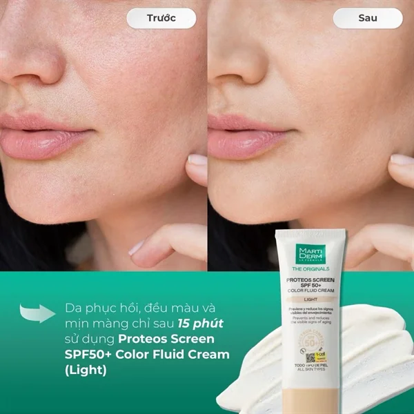 Kem chống nắng nâng tông MartiDerm Proteos Screen SPF50+ Color Fluid Cream